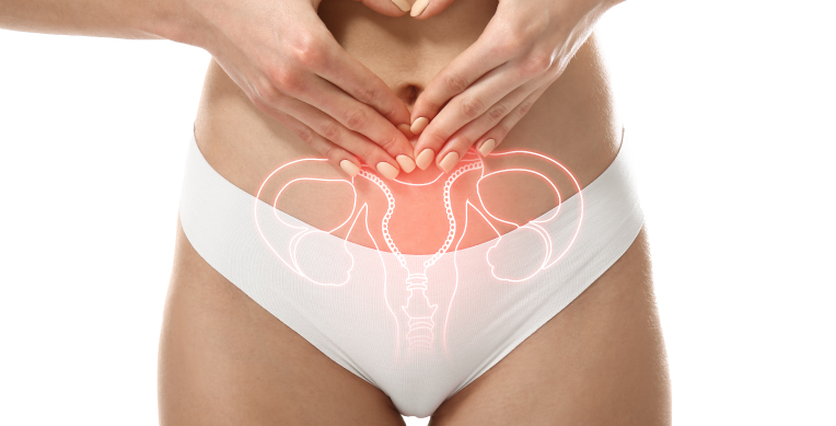 día-mundial-de-la-endometriosis-nosotras-pais-int-articulo-5