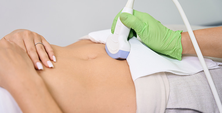 sindrome-asherman-cl-interna-1