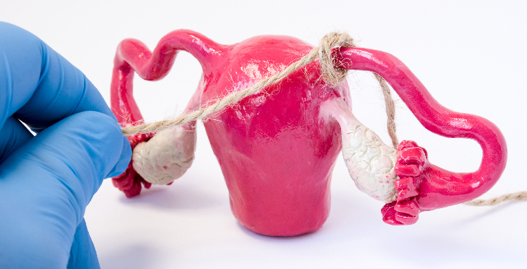 me-cuido-te-cuido-nos-cuidamos-que-alternativas-en-metodos-anticonceptivos-hay-preservativos-vulva-vagina