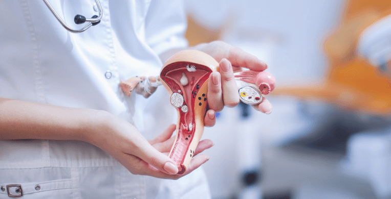 Alguna vez te has preguntado ¿qué son los ovarios poliquísticos? En este artículo tenemos las respuestas a tus preguntas ¡conócelas!