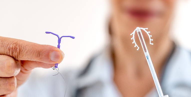 me-cuido-te-cuido-nos-cuidamos-que-alternativas-en-metodos-anticonceptivos-hay-diu