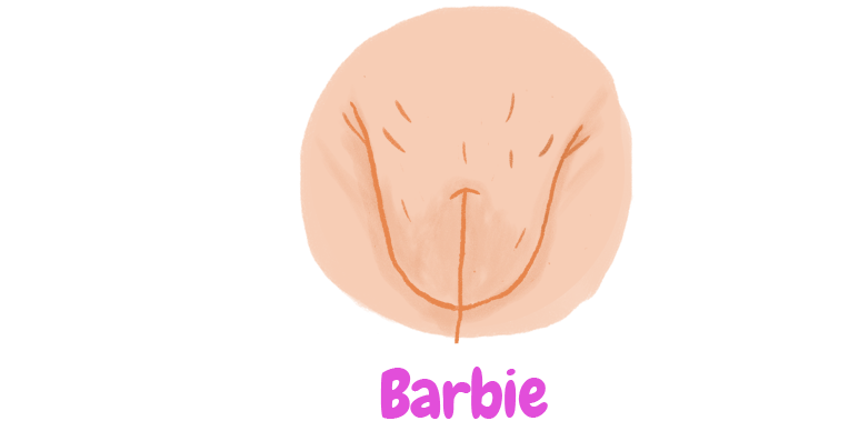 no-todas-las-vaginas-son-iguales-3