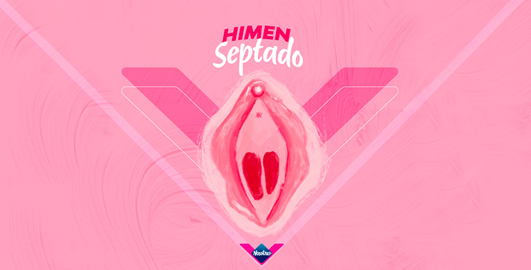 tipos-himen-3