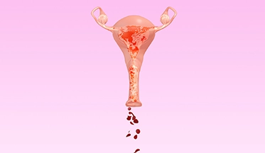 Metro…¿qué? ¡Aprende a identificar un sangrado intermenstrual!