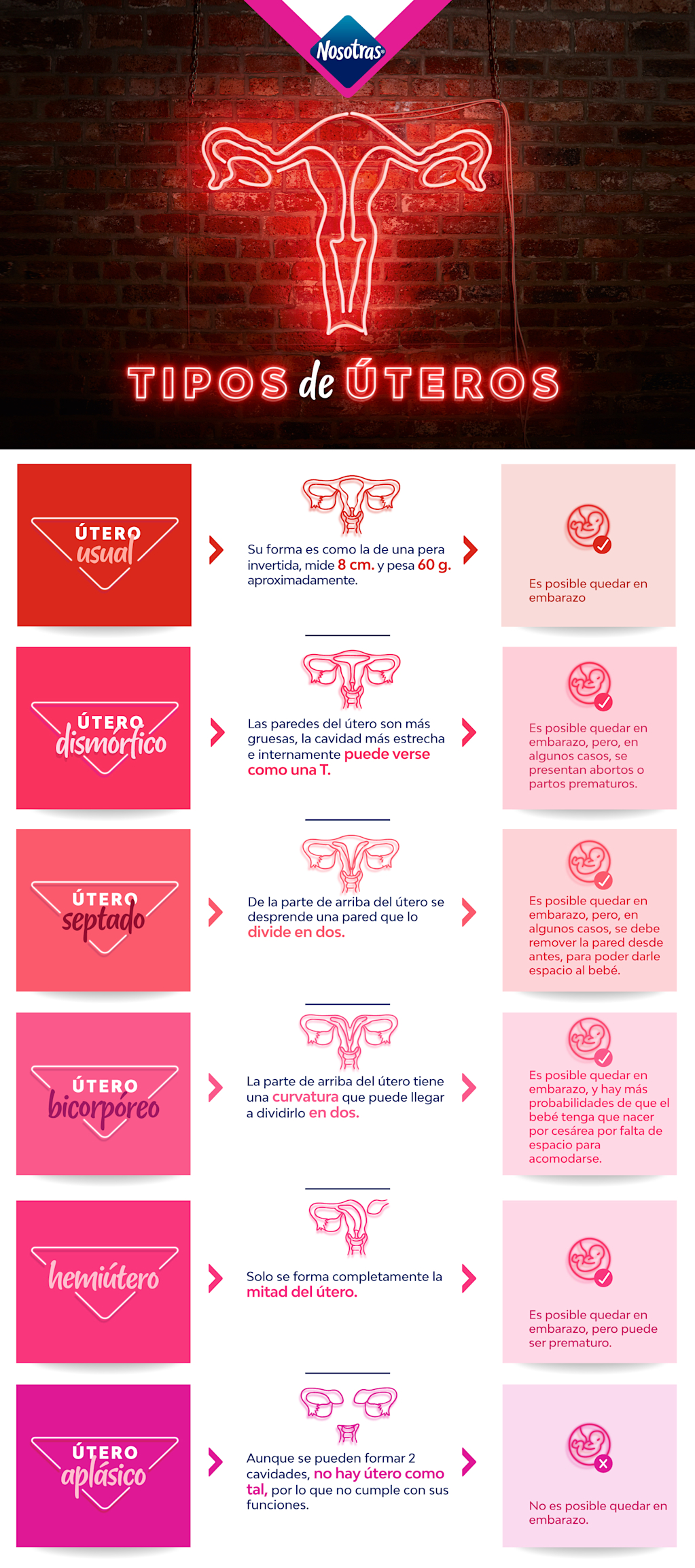 tero En Retroversi n Y Tipos De tero Conoce Sus Diferencias tero-en-retroversi-n-y-tipos-de-tero-conoce-sus-diferencias