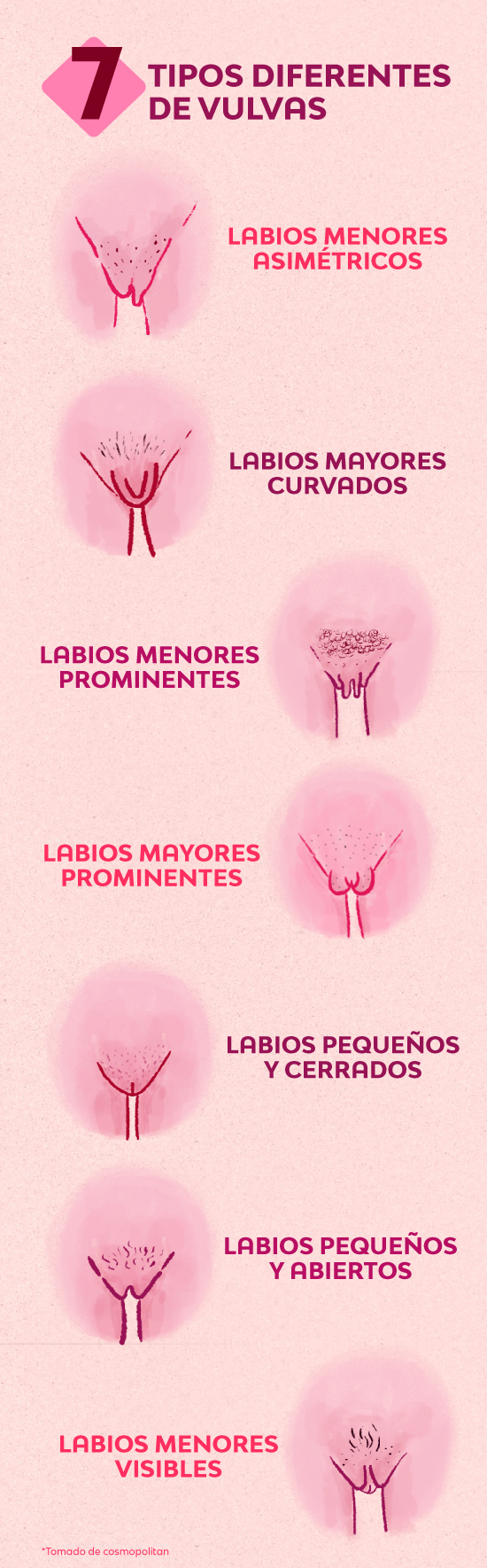 labios-vaginales-todo-lo-que-necesitas-saber-infografico-interna-2