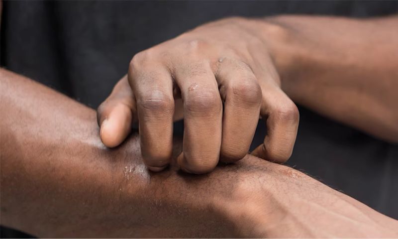 A person scratching their arm, highlighting an itchy and dry skin condition