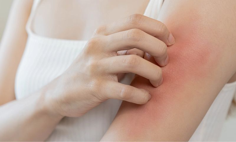 A person scratching their arm, highlighting an extra dry skin condition