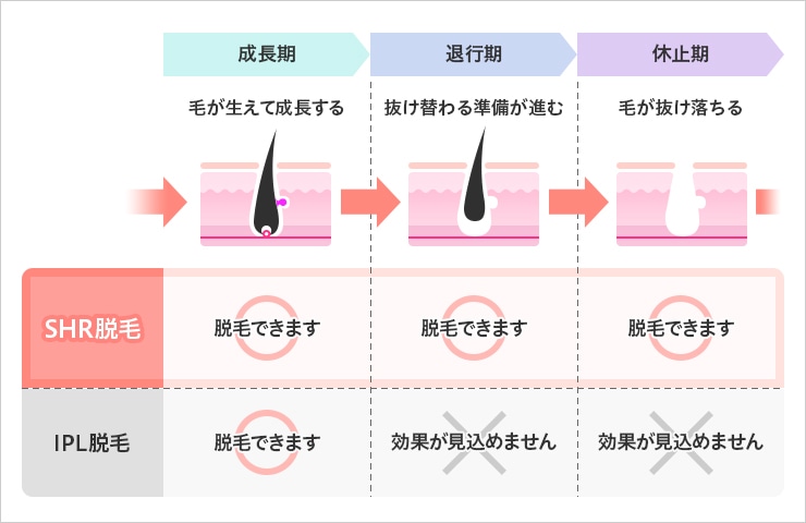 毛周期と脱毛できるタイミング