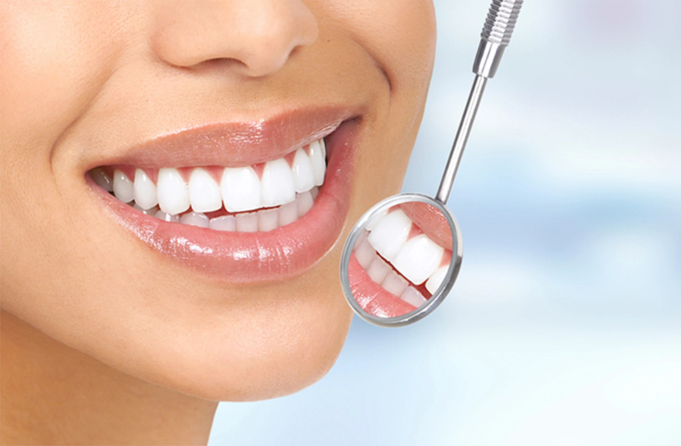 Fluoride Rinses in Caries Prevention
