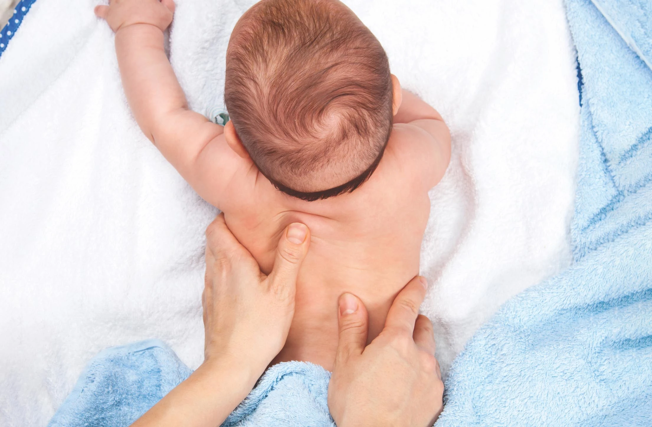 Common Baby Rash