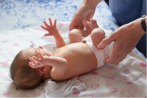 How to Treat Nappy Rash