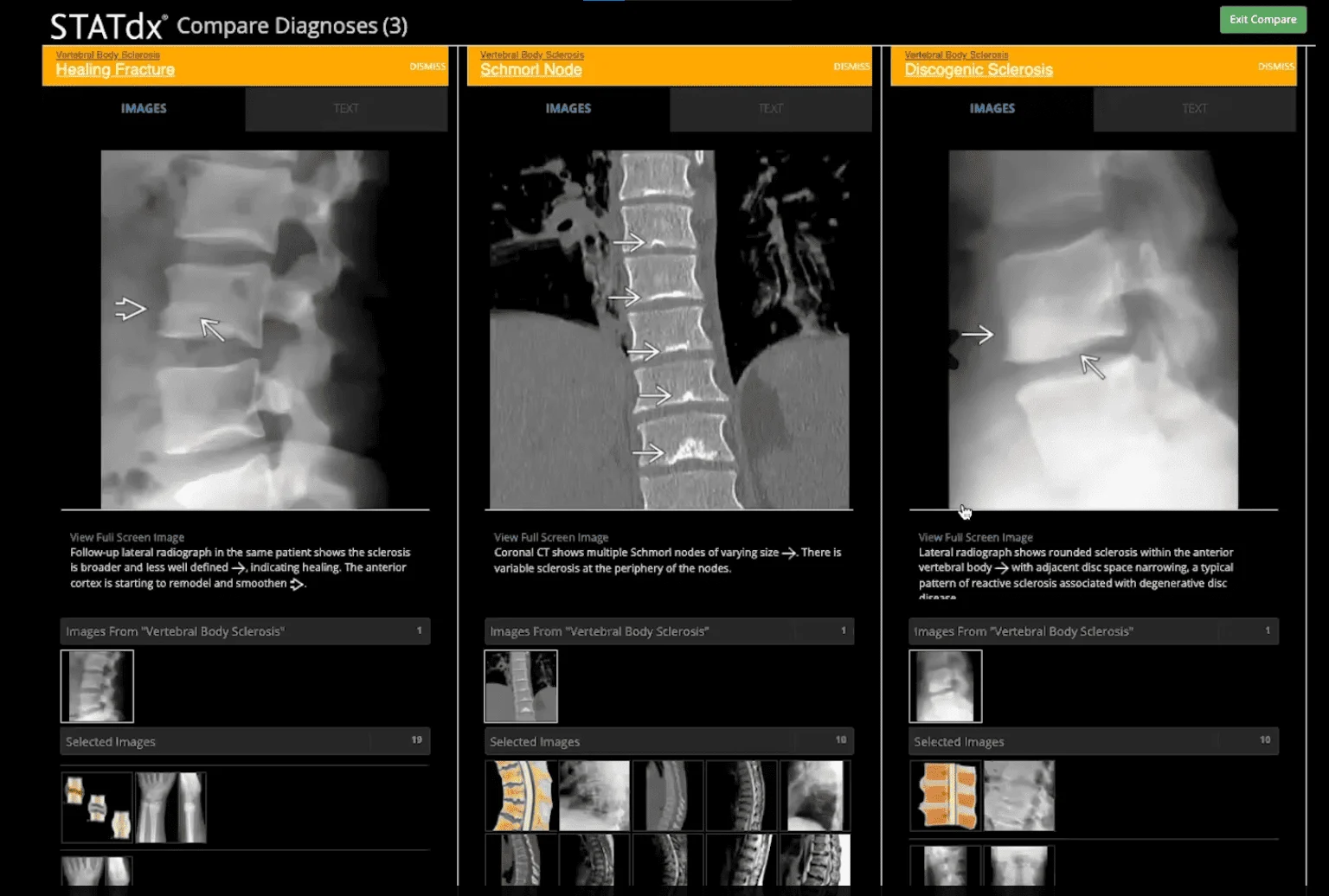 An interactive STATdx case-based session demonstrating the use of Clinical Diagnostic Support Solutions with Dr Peter Leander, Chief of Radiology at Region Skane, Sweden.