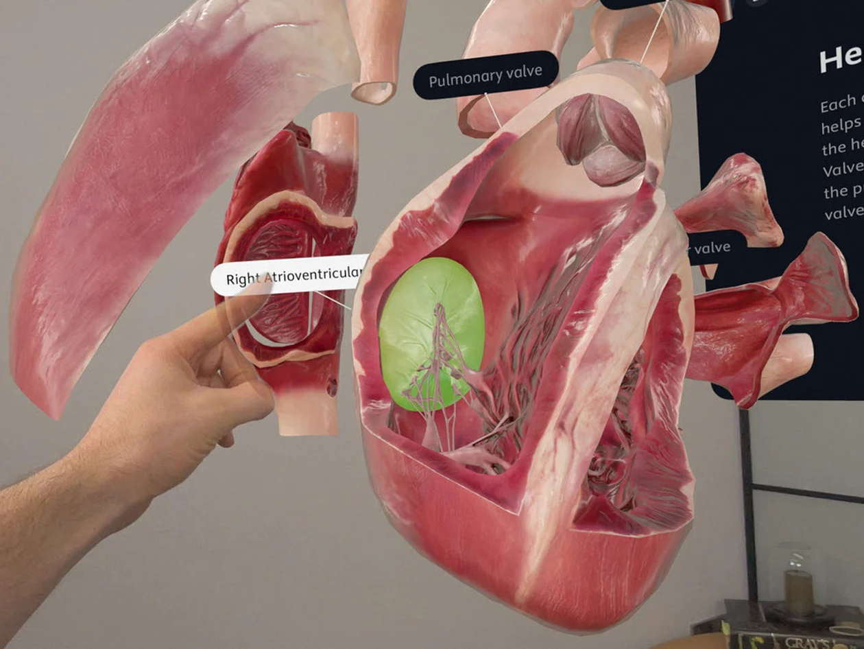 Screenshot of heart valves in Complete Heartx