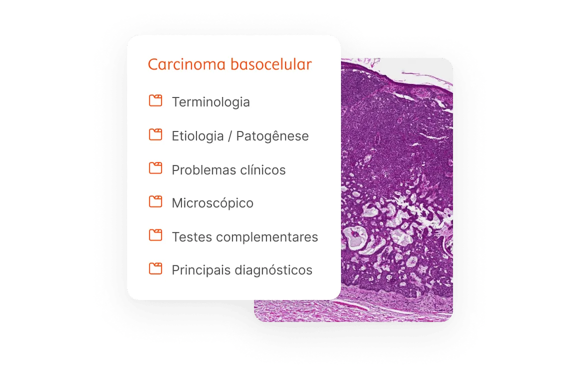 Basal Cell Carcinoma Image List Benefit