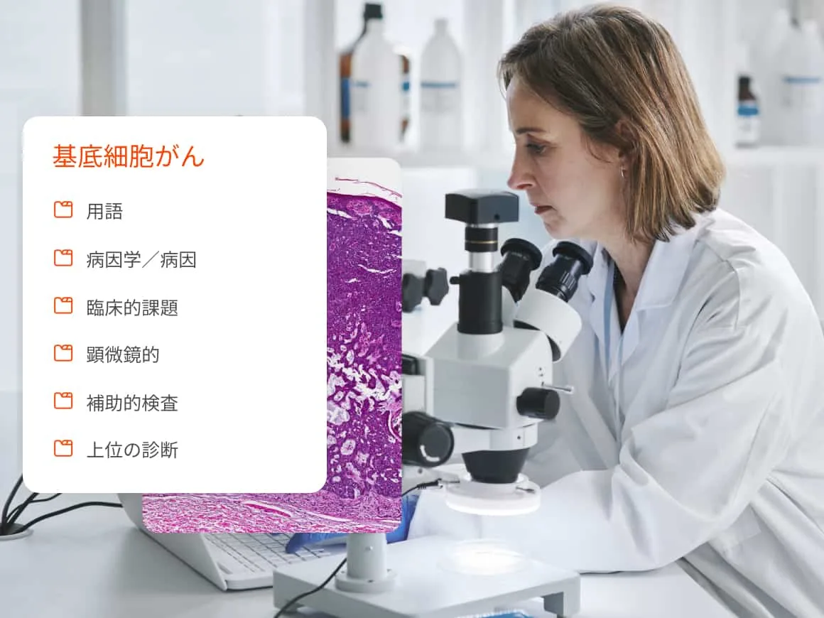 Doctor using microscope with overlay of basal cell carsinoma content