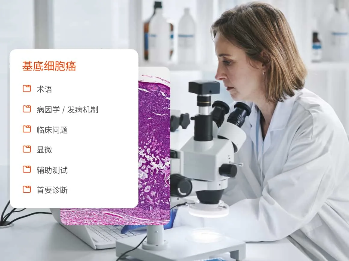 Doctor using microscope with overlay of basal cell carsinoma content