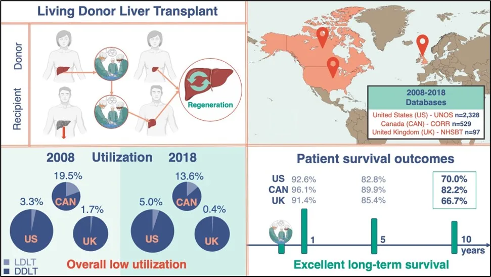 Illustration showing living donor liver transplantations in the US, Canada, and UK