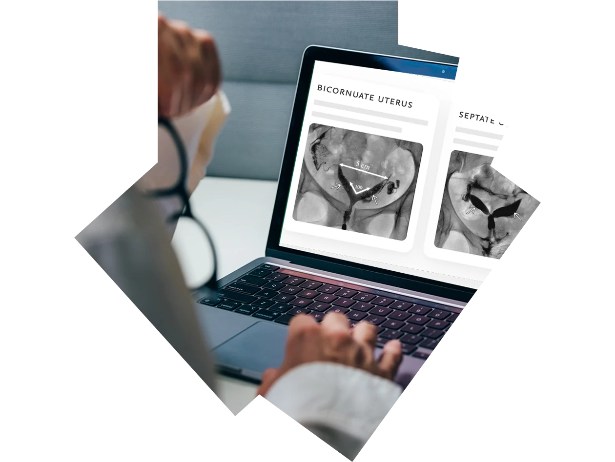 X-ray photographs of a bicornate uterus and a septate uterus