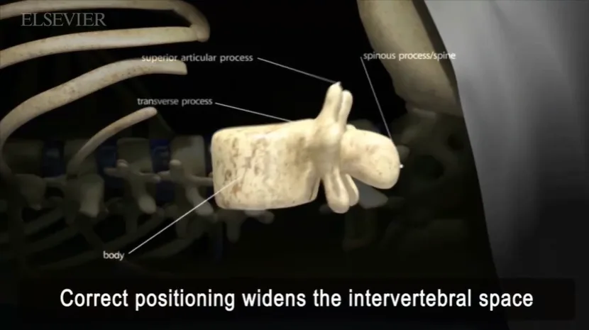 Still 3D image of intervertebral space from Clinical Skills video