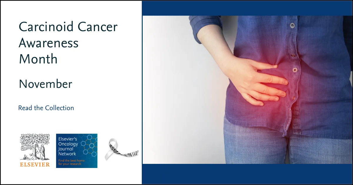 Carcinoid Cancer image