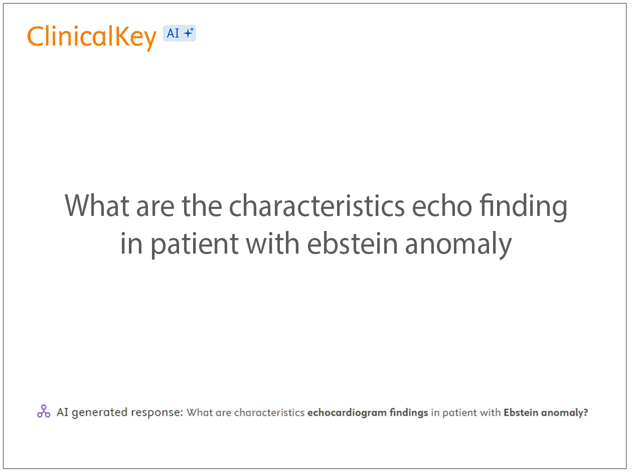 What are the characteristics echo finding in patient with ebstein anomaly