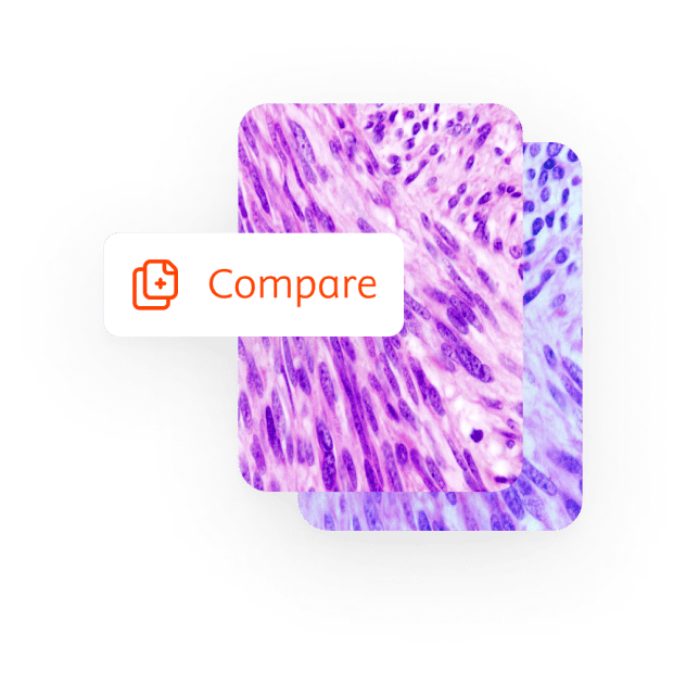 Image Comparison Feature