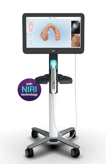 ITERO SCANNER — Valiente Dental