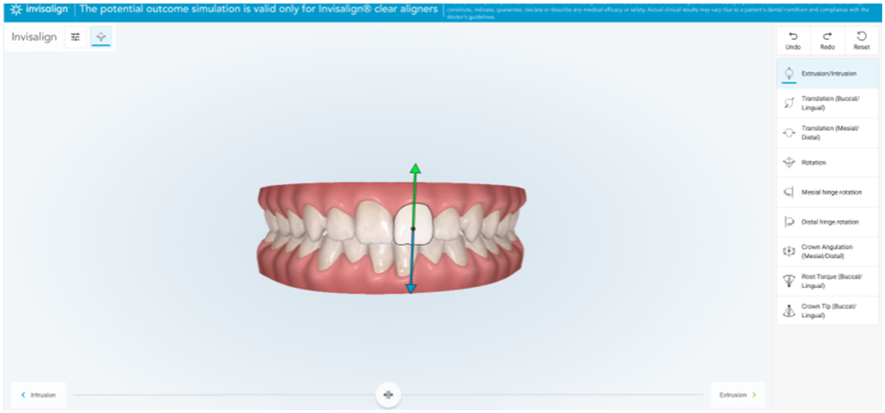 iTeroEd - Invisalign® Outcome Simulator Pro 3D Controls