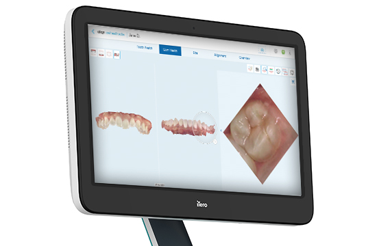GumHealth_Diagnosis.webp