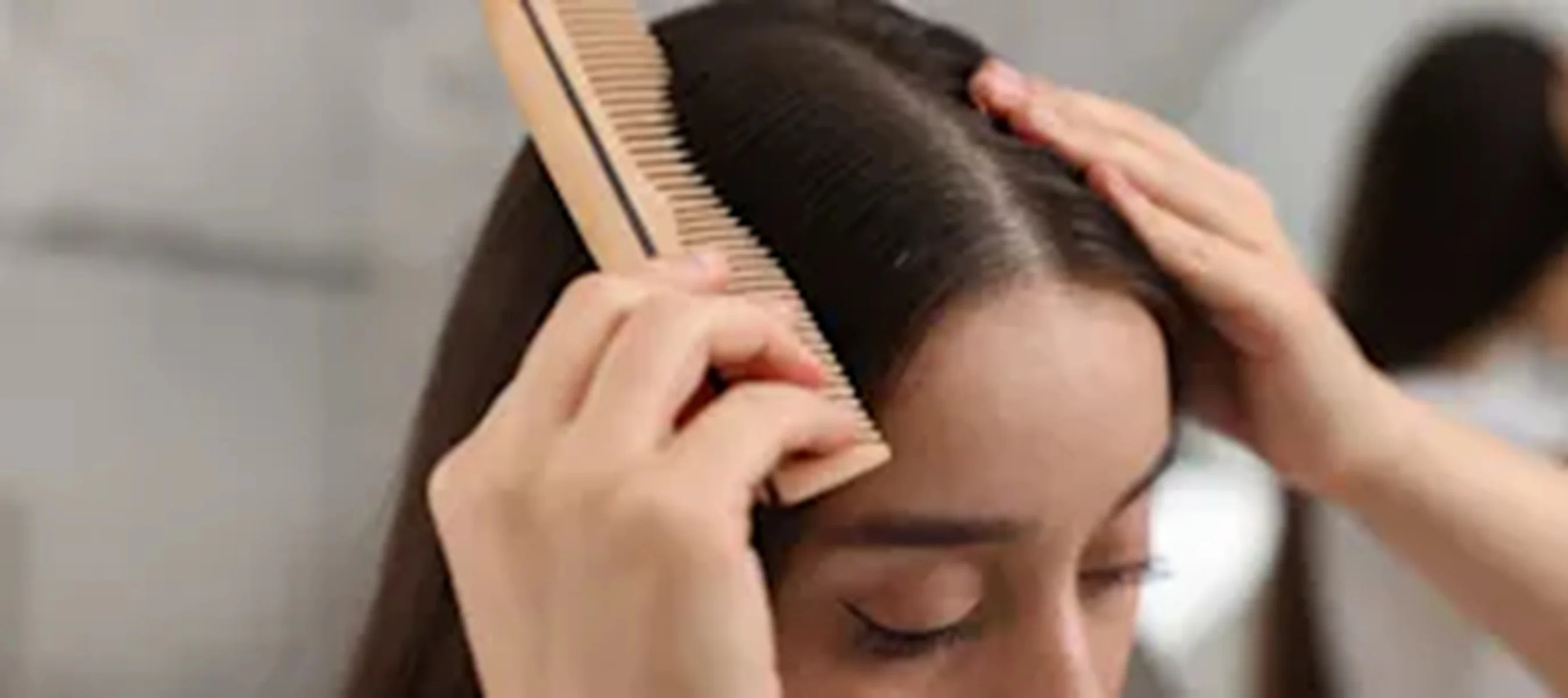 Can the Wrong Shampoo Cause an Itchy Scalp?
