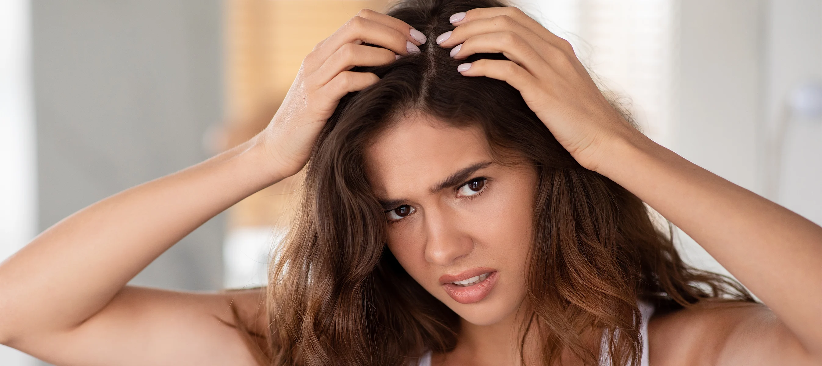 Effective Strategies for Managing Dandruff and Itchy Scalp