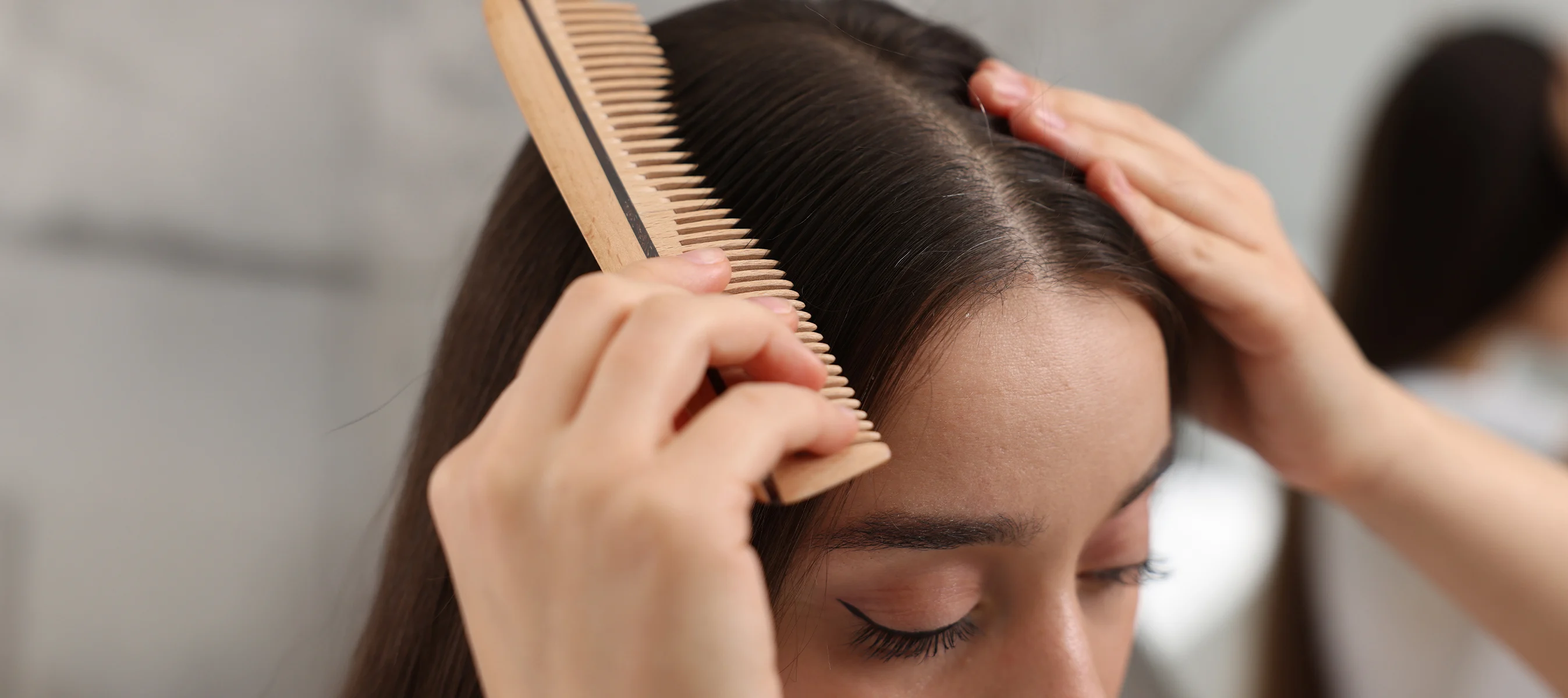 A Solution for Every Scalp: Choosing the Right Dandruff Care