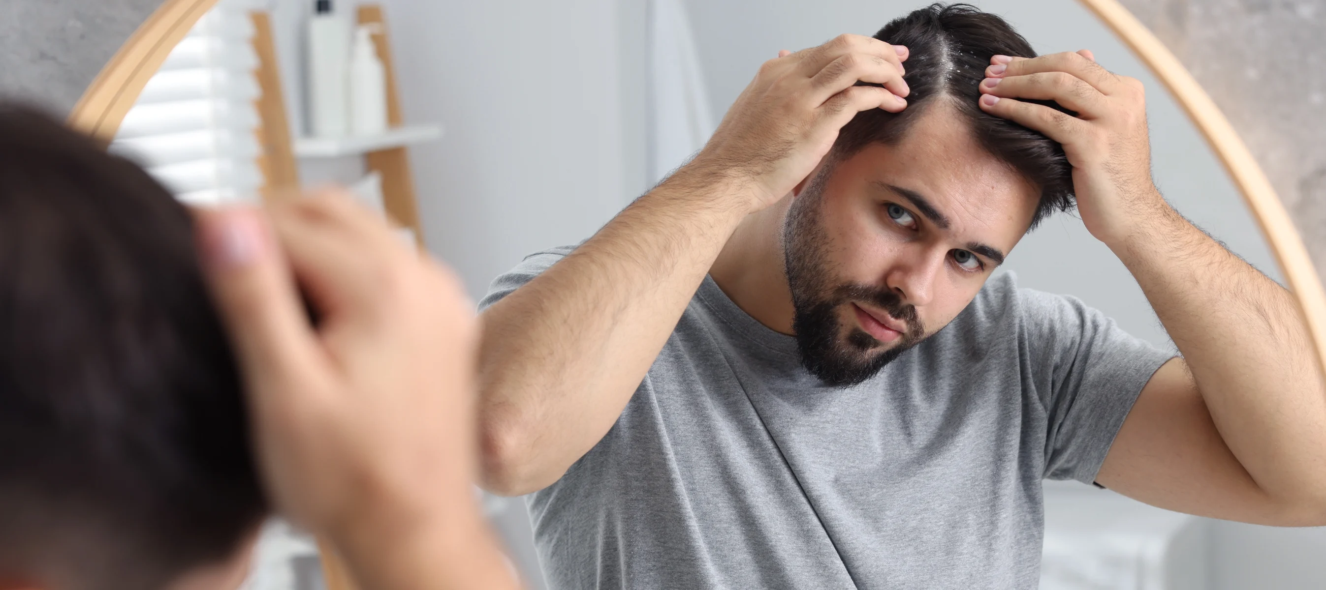 Can Severe Dandruff Treatments Harm Your Hair? What to Know About Medicated Anti-Dandruff Shampoos