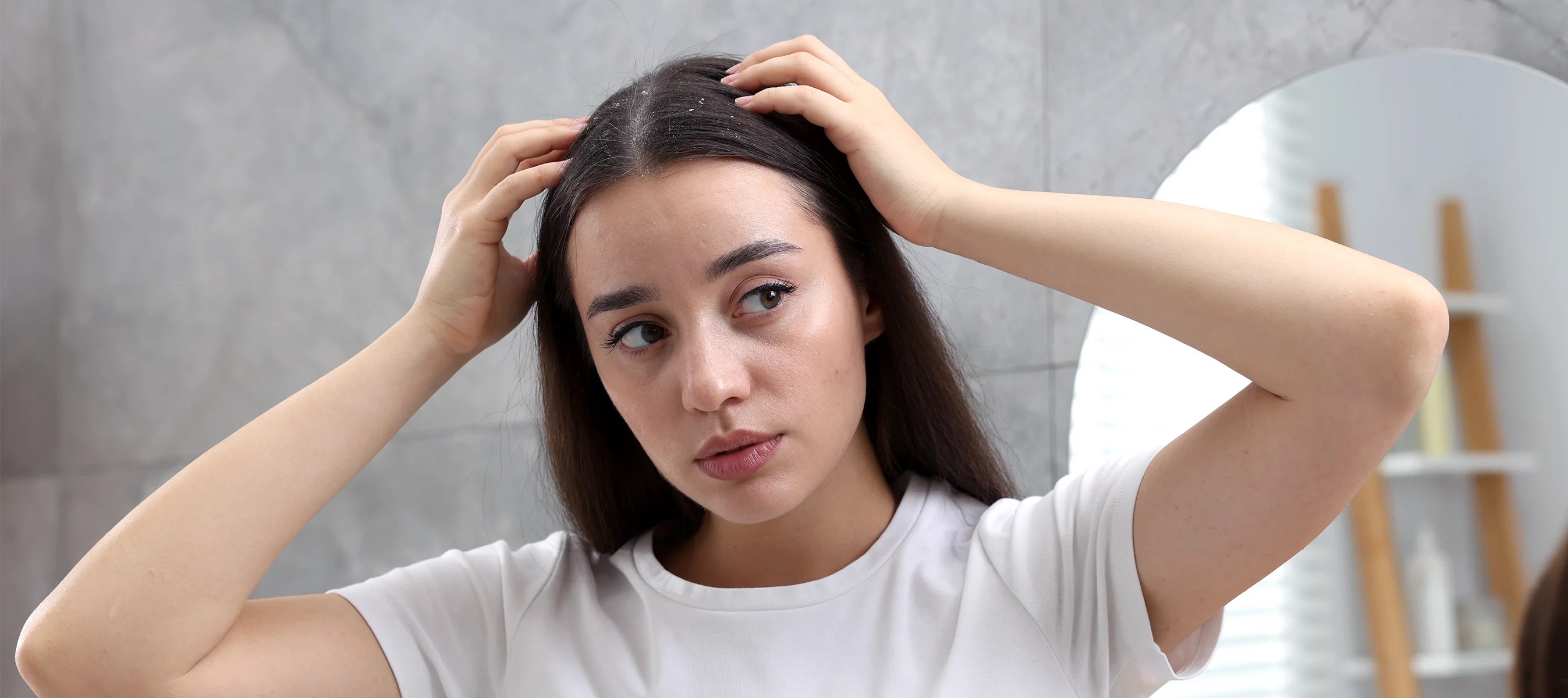 How To Know If You Need a Prescription-Strength Shampoo
