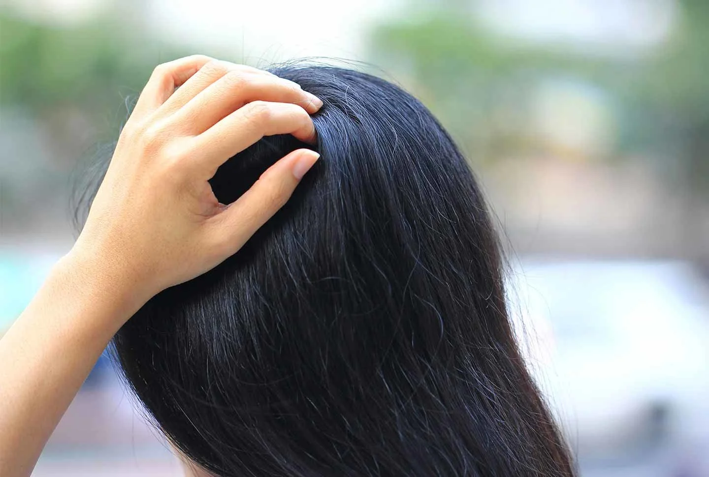 FAQ: WHAT CAUSES ITCHY SCALP AND HOW DO YOU TREAT IT? FAQ: WHAT CAUSES ITCHY SCALP AND HOW DO YOU TREAT IT?