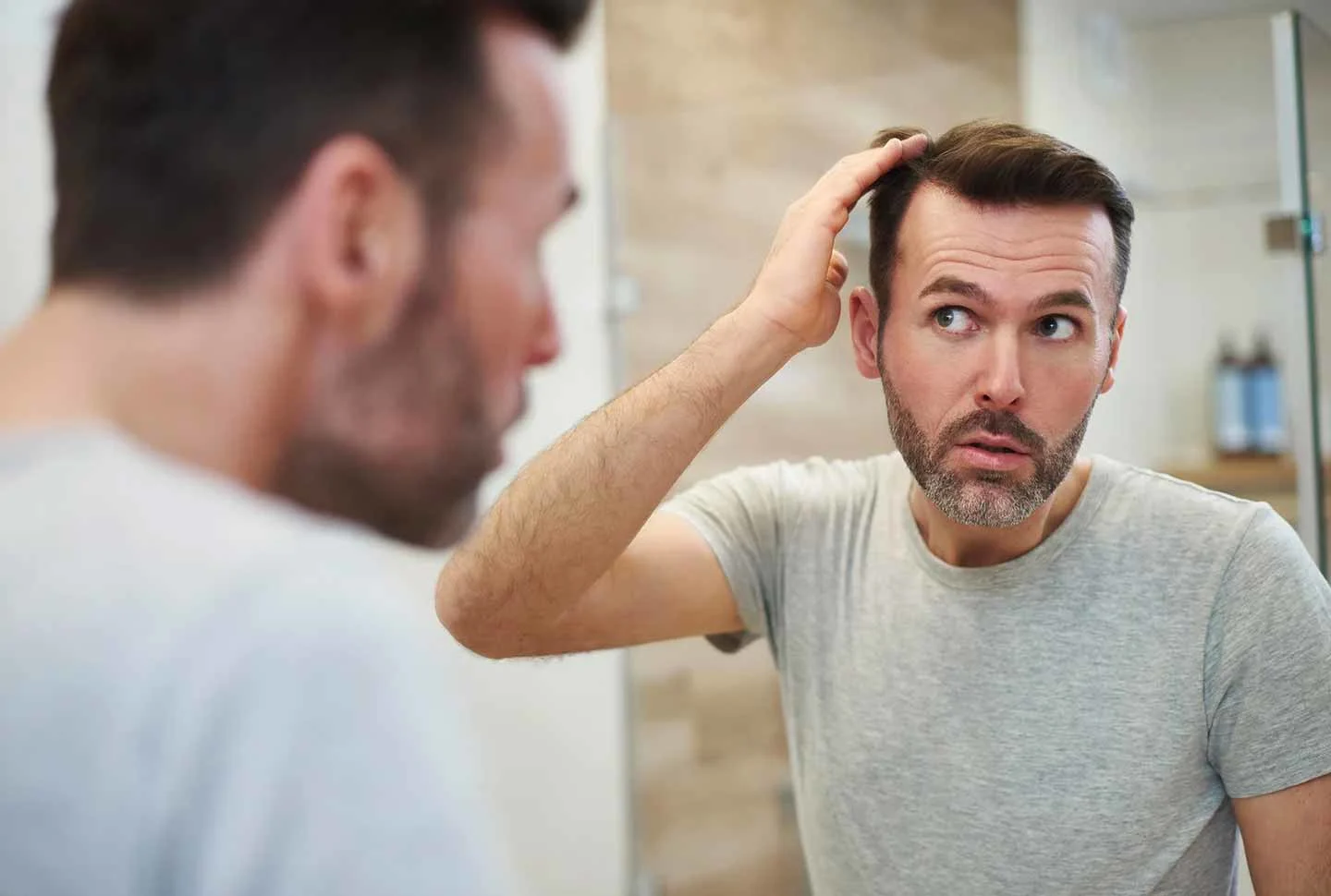 DO I HAVE DANDRUFF?