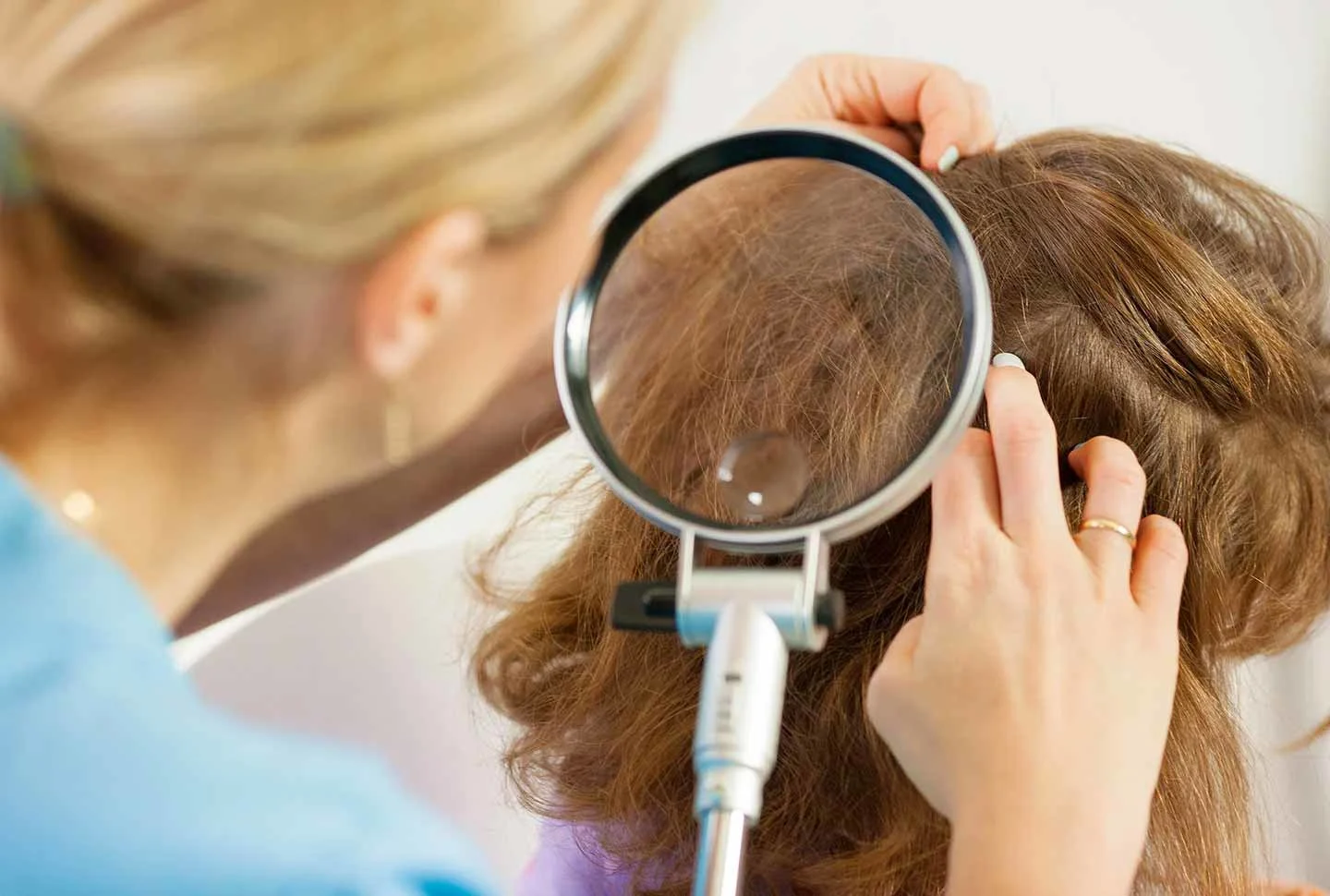 FAQ: IS DANDRUFF A FUNGUS?