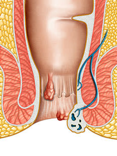comment fonctionne le canal anal