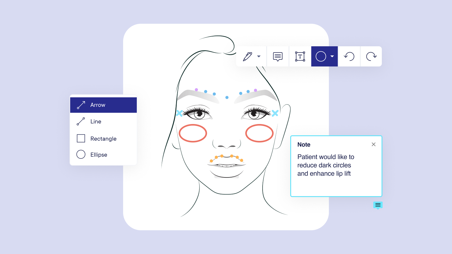 face-charts-templates-for-spas-salons-and-tattoo-shops-mangomint-salon-and-spa-software for Free Printable Botox Face Chart Face charts: Templates for spas, salons, and tattoo shops | Mangomint Salon and Spa Software for Free Printable Botox Face Chart