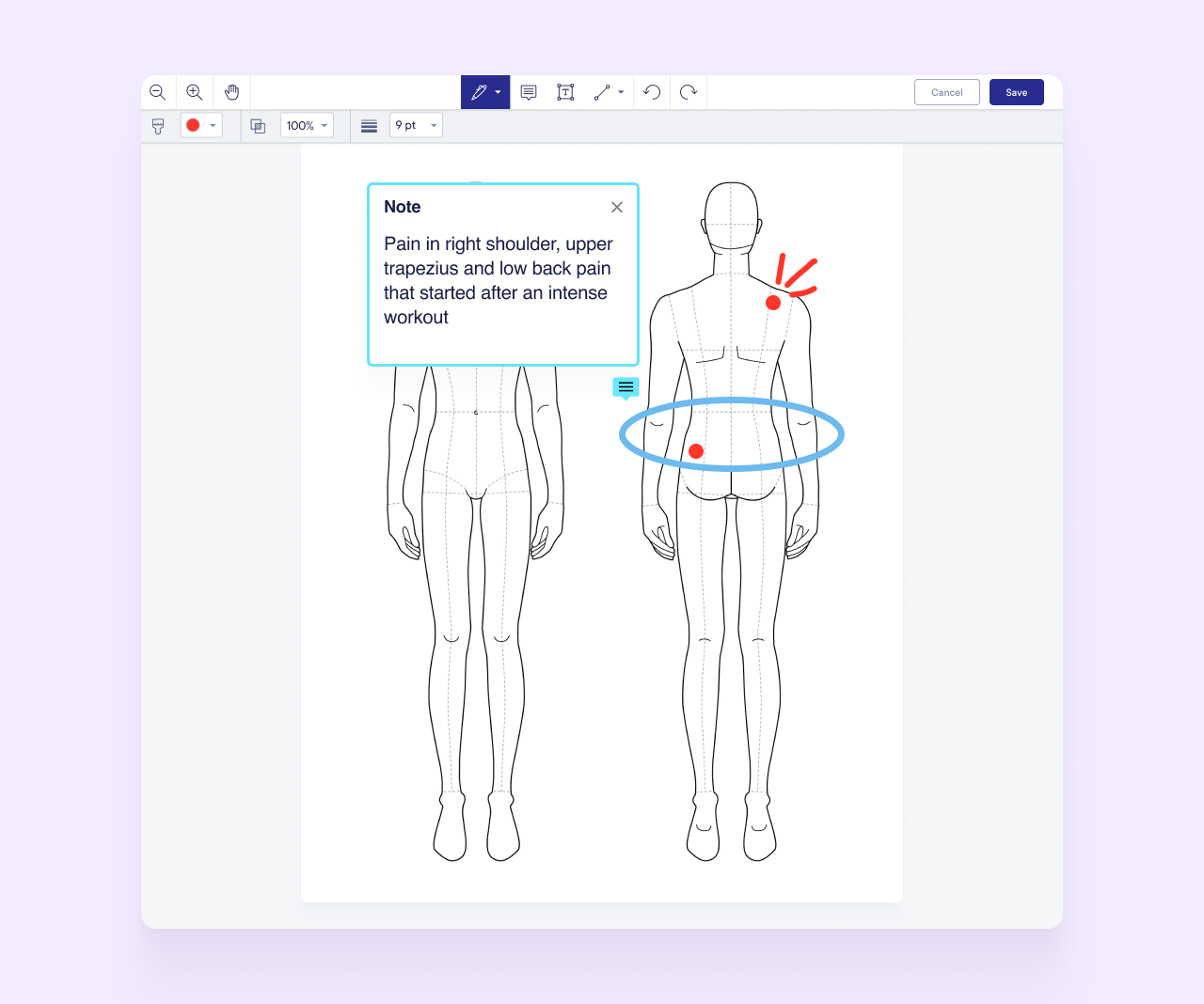 Meet Image Markup, a powerful new addition to Integrated Forms ...