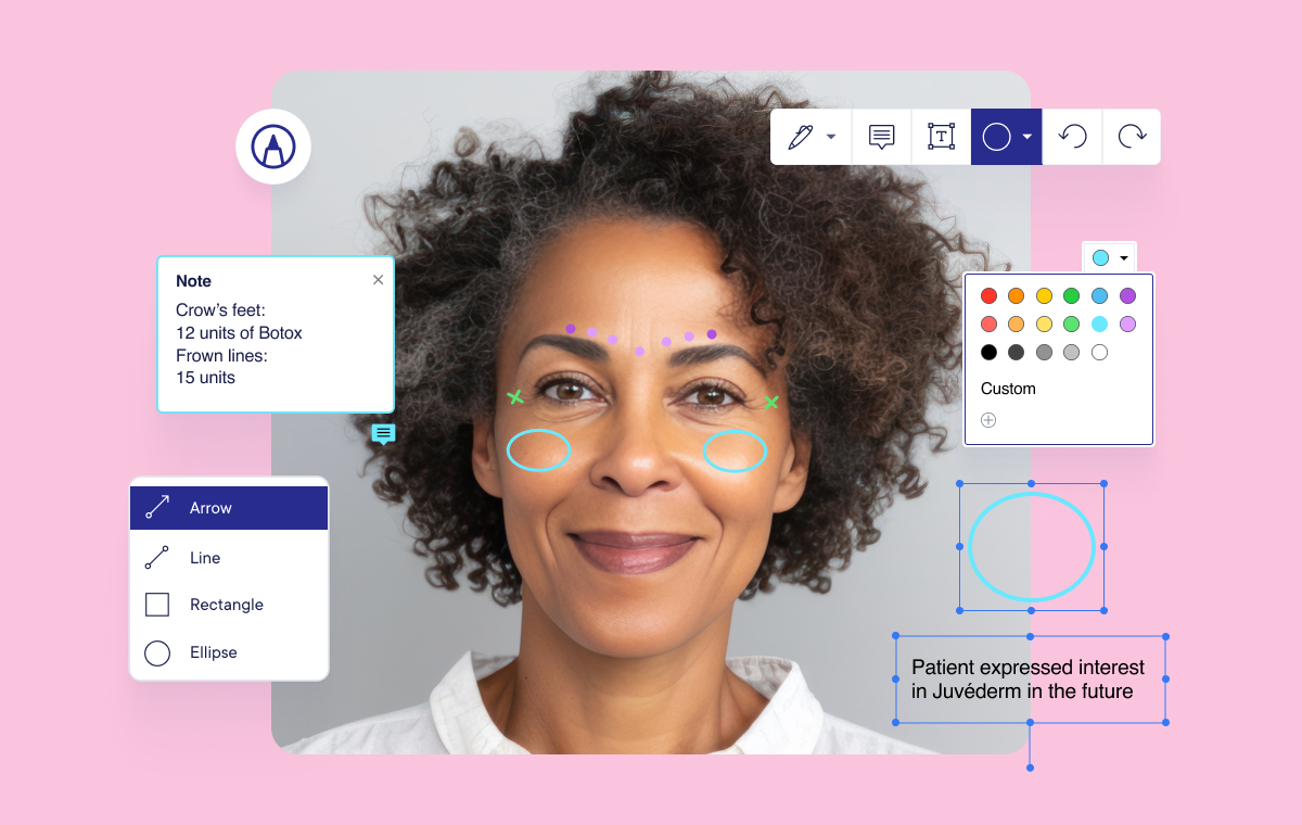 Image Markup for Med Spas