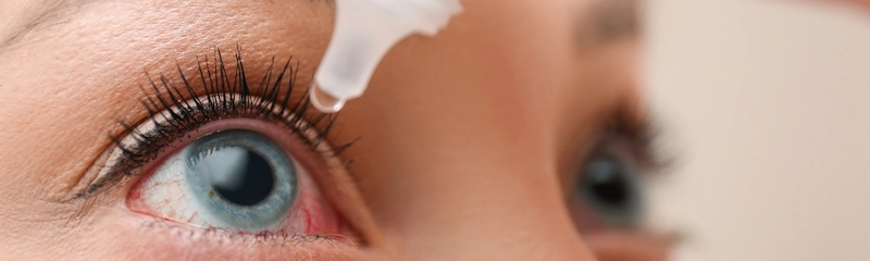 How to Treat Dry Eyes During Allergy Season