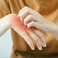 What Causes Eczema Flare-Ups? Common Triggers