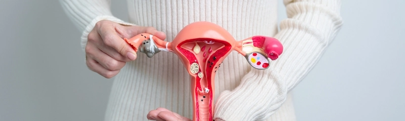 How to Lose Weight With PCOS: Practical Tips