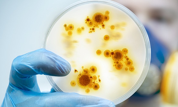 The Difference Between A Bacterial Vs. Viral Infection