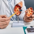 Can You Live Without a Kidney? What to Expect