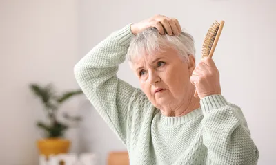 Can Rheumatoid Arthritis Cause Hair Loss