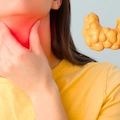 Is 100 Mcg of Levothyroxine a High Dose? Dosage Guide