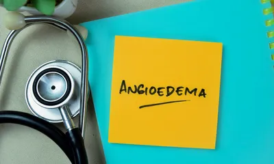 What is Hereditary Angioedema